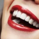 femme-sourire-dents-blanches